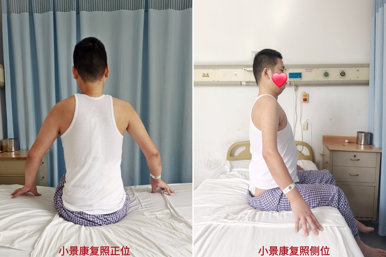术后_副本_副本.jpg